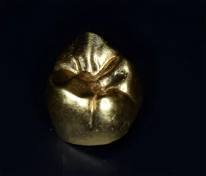 ゴールドクラウン