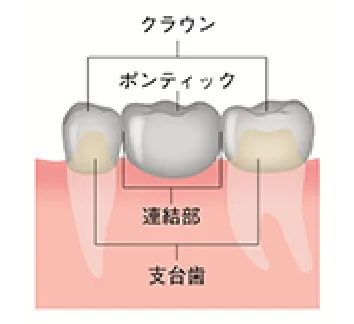 ブリッジ